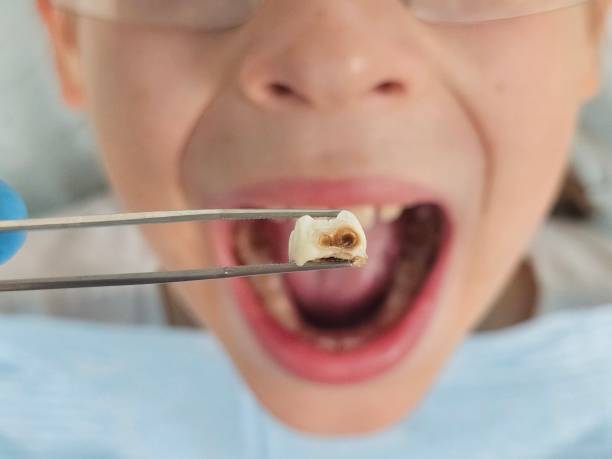 Best Emergency Treatment for Toothache in Corpus Christi, TX